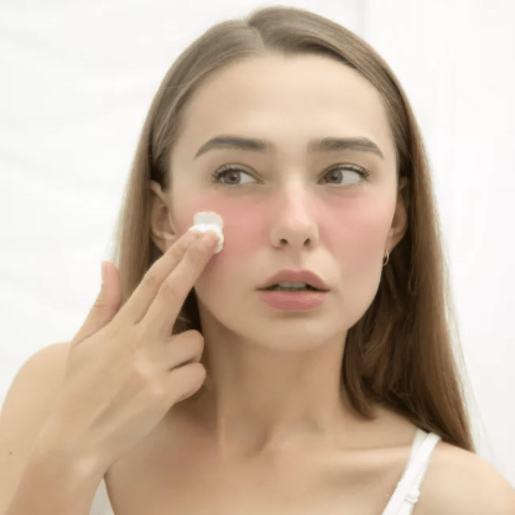 Care este diferența între Rozacee și Cuperoza - WowSkin Romania
